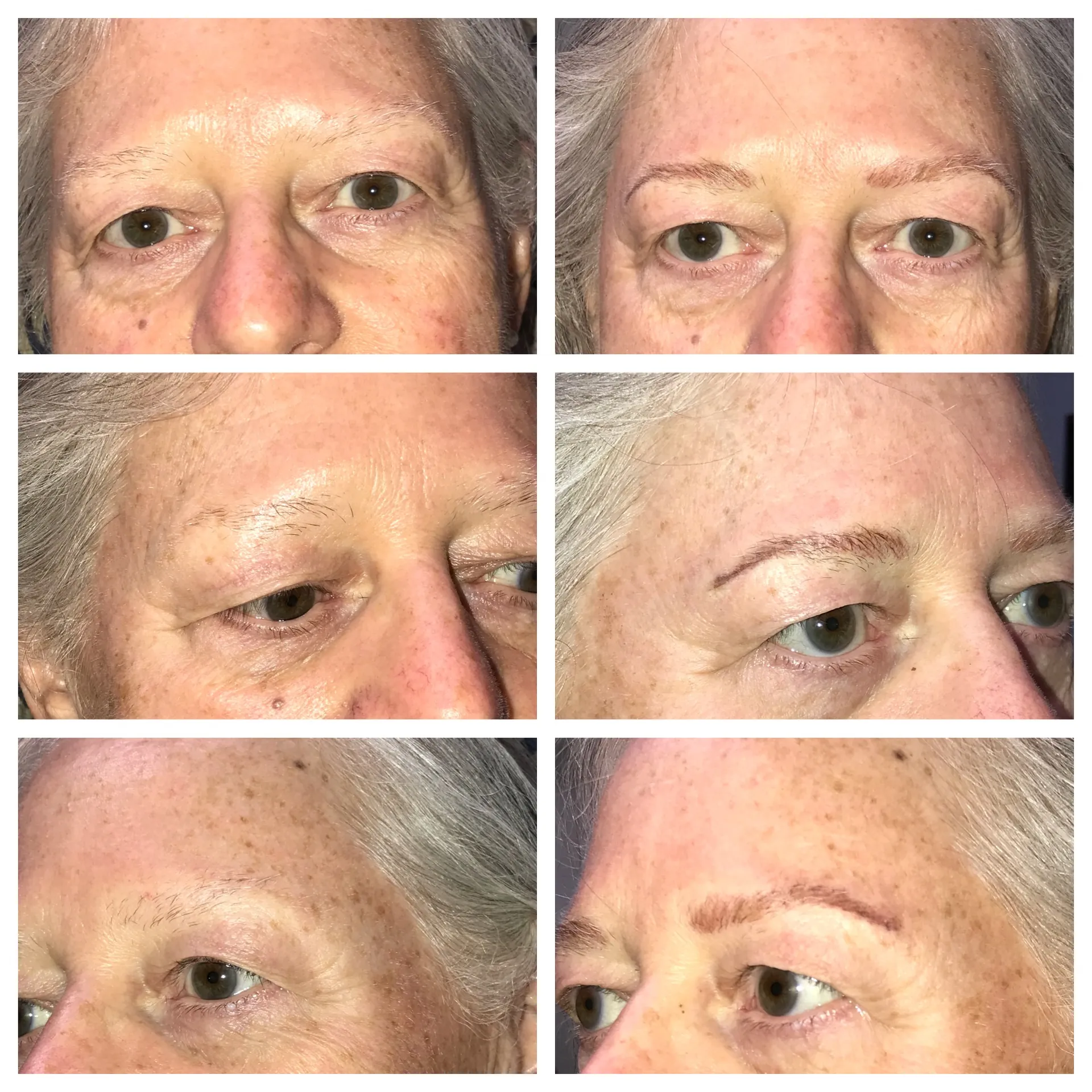 Permanent Eyebrow Transformation 6