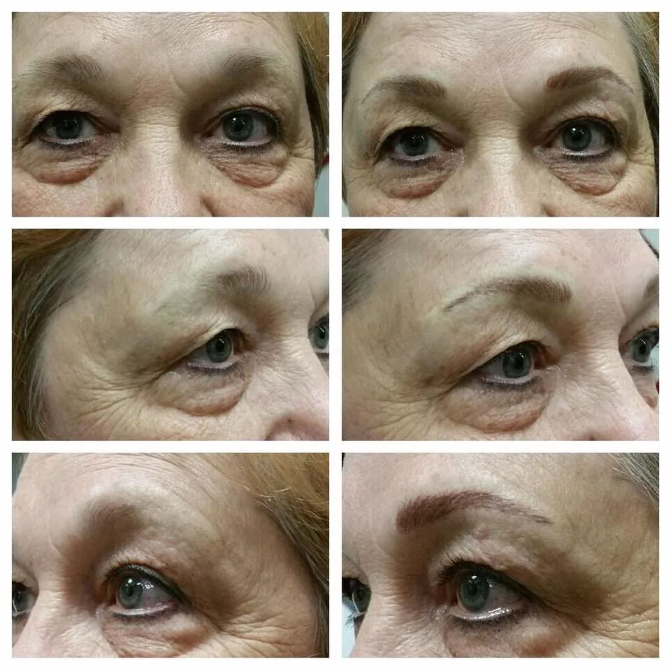 Permanent Eyebrow Transformation 3