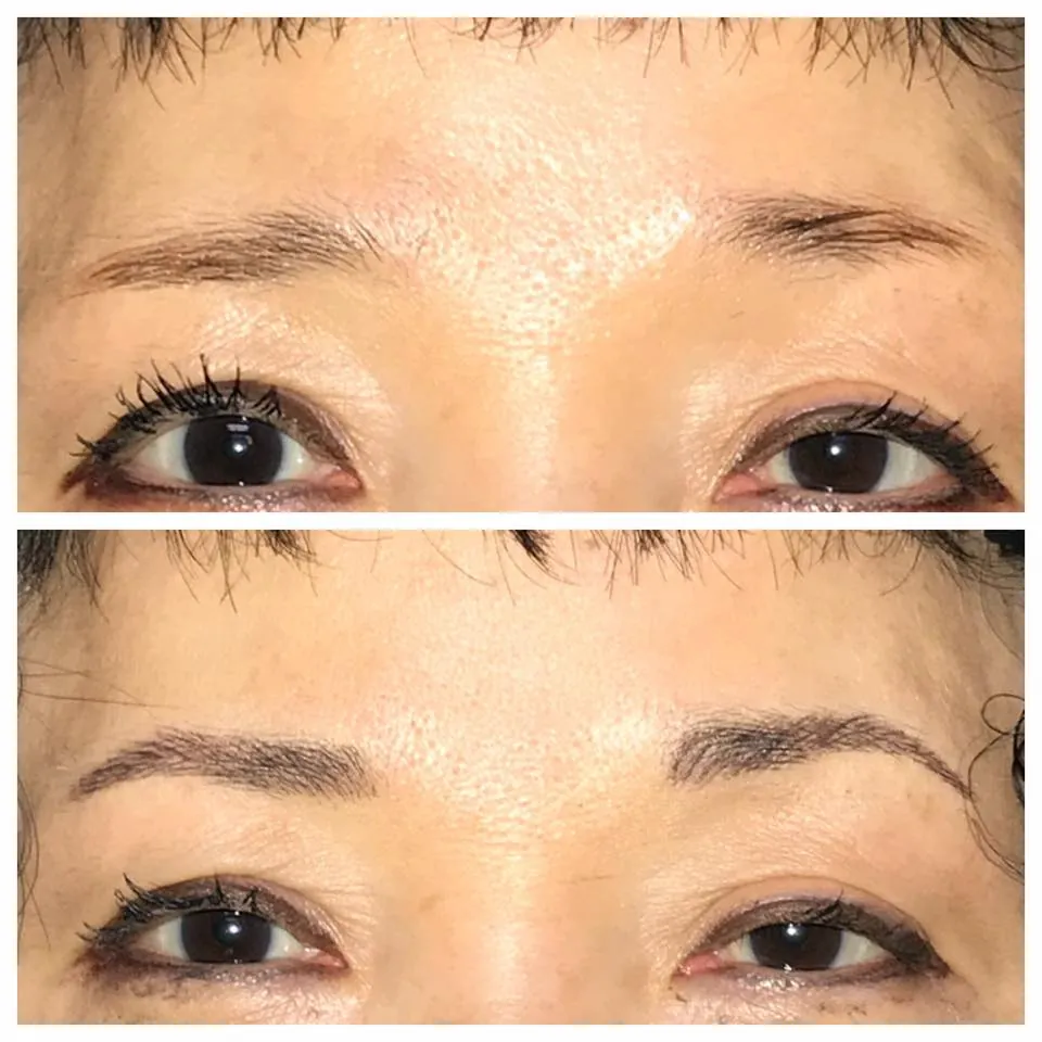 Permanent Eyebrow Before After 5