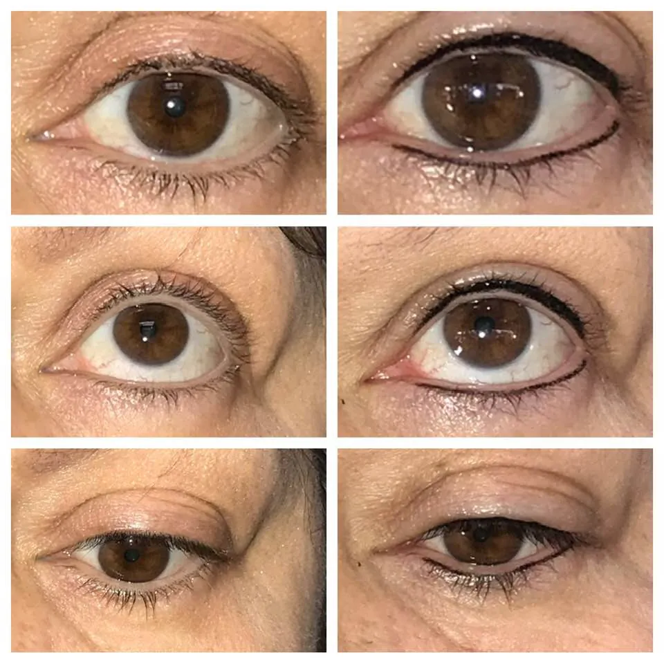 Permanent Eyeliner Transformation 2