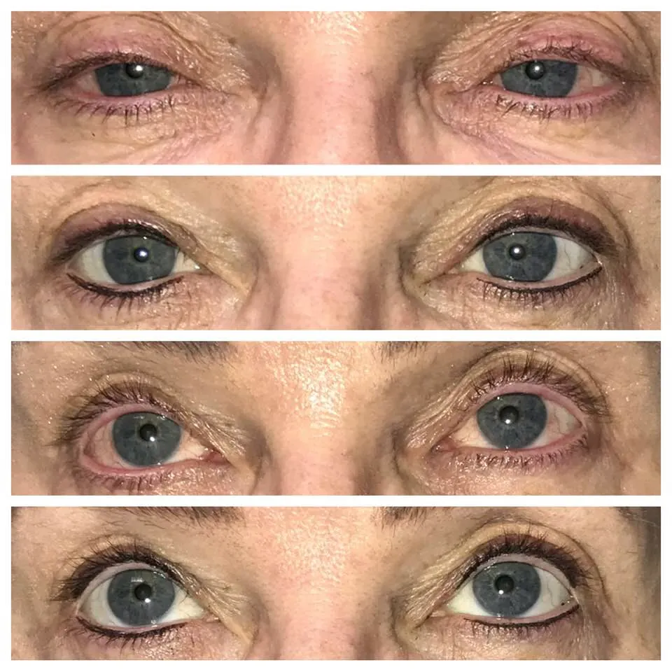 Permanent Eyeliner Transformation 4