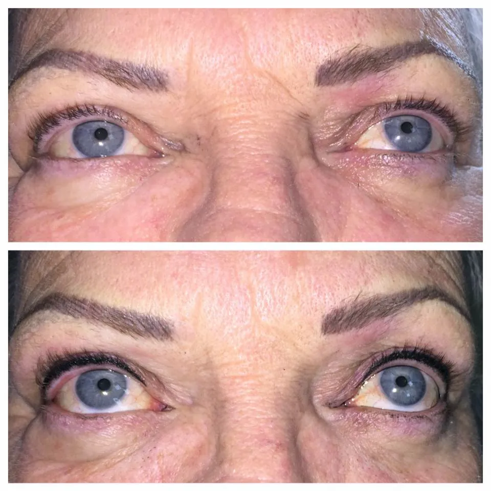 Permanent Eyeliner Transformation 5